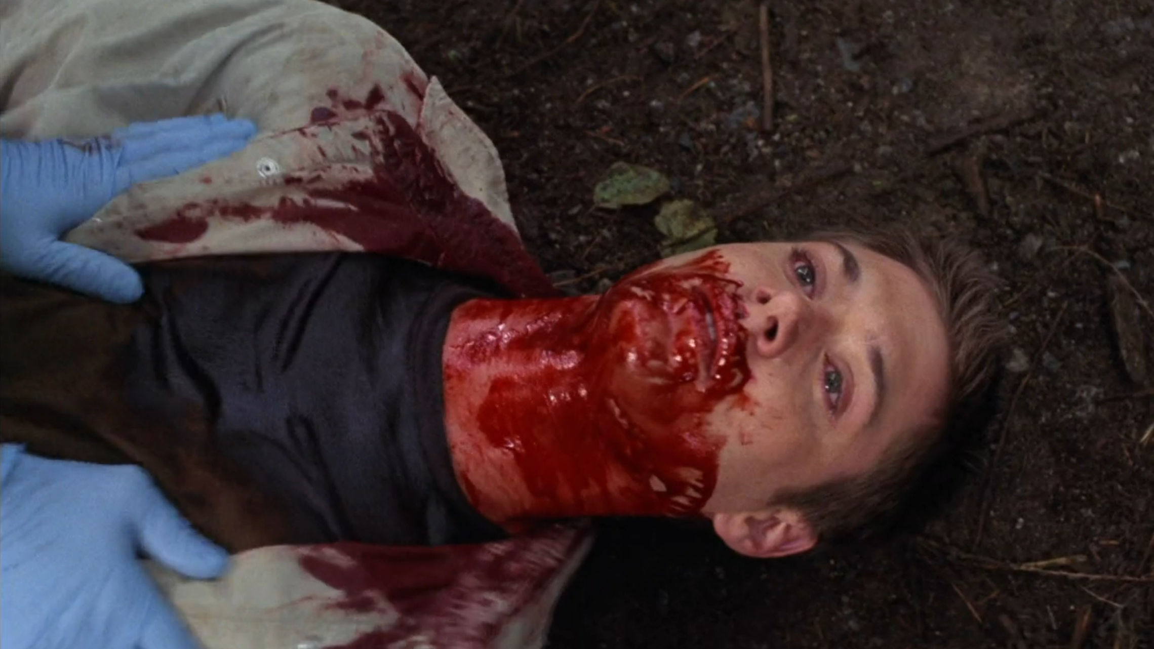 Jake is bloody and having a bad day